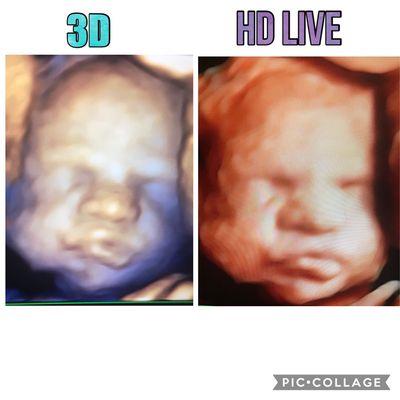 3D vs HD live