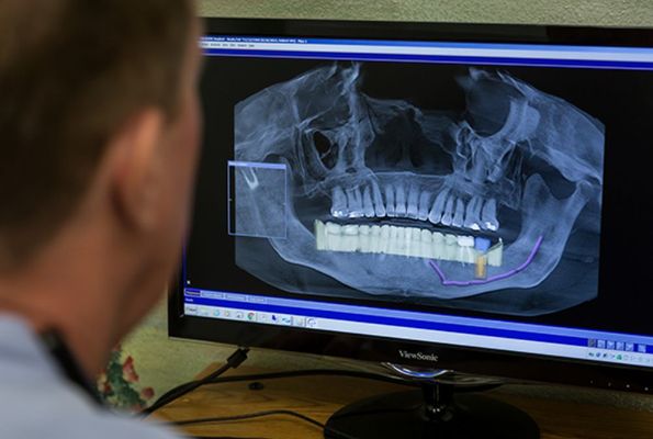 Digital x-rays, ct. Scan