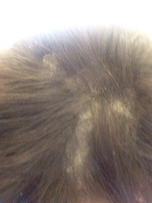 I have bald spots in my closure after a few months