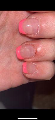 Cut cuticles