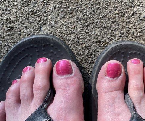 First time I'm embarrassed to wear flip-flops 3 days after my pedicure.