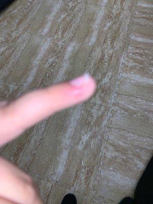 This is after a week the infection still has not passed and I have a small bubble on my finger