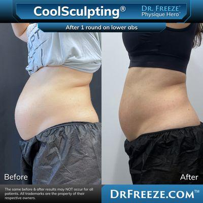 Dr. Sculpt CoolSculpting & EmSculpt Center