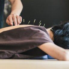 Acupuncture uses super thin needles and is usually painless yet very effective