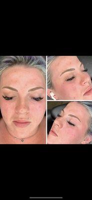 Microblading