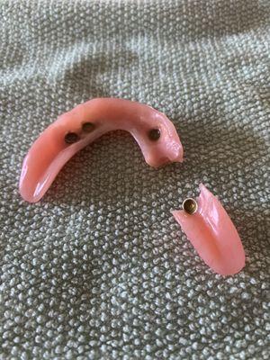 This is my denture that broke 6 times! They refuse to honor their warranty!