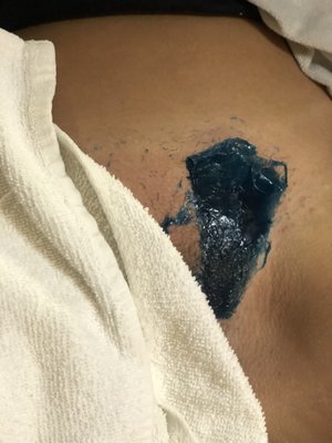 Hard Waxing Brazilian