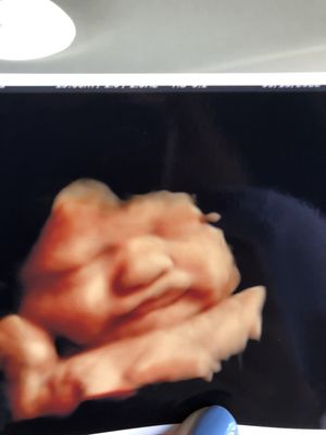 Ultrasound photos