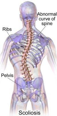 Dr. Claire DeFazio specializes in scoliosis brace for correction in children and pain management in adults.