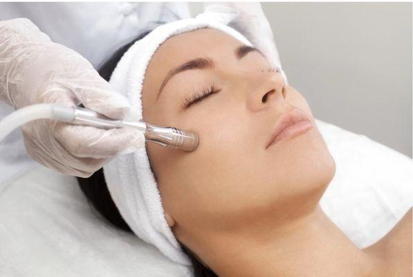 Microdermabrasion