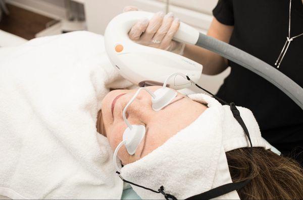 Ipl Photofacial