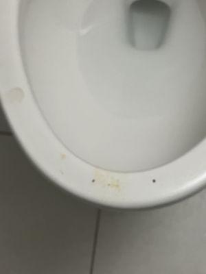 Shit smeared toilet that had not been used by either patient in the room. Still there after 36 hours.