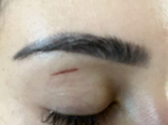 Scar on my eyebrow from wax being 2 hot.