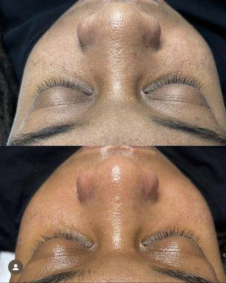 Signature facial