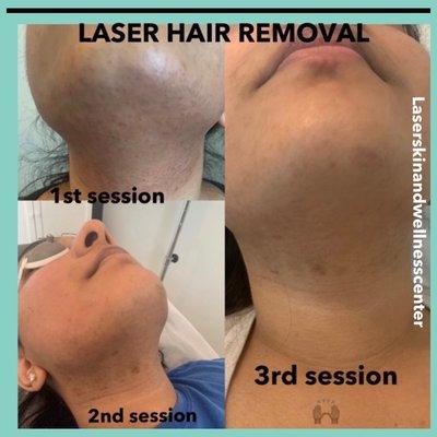 Laser Skin Wellness Center