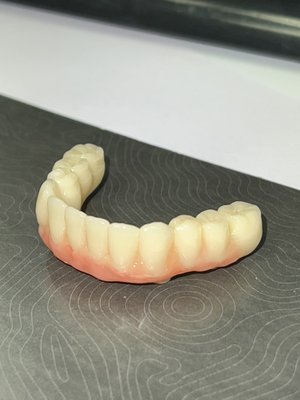 3D printed All on 4 Provisional Teeth