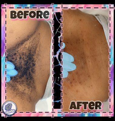 $40 BRAZILIAN WAXING