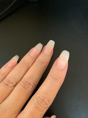 Pointer finger different shape that other nails.