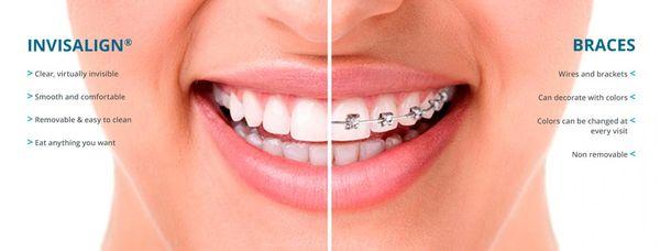 We offer Invisalign and traditional braces