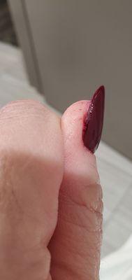 Stained clown cuticles, missing entire side