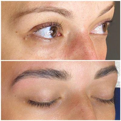 Brow Rehab only 6months later