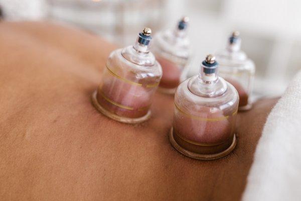 Cupping