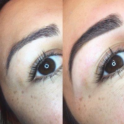 Brow reshape