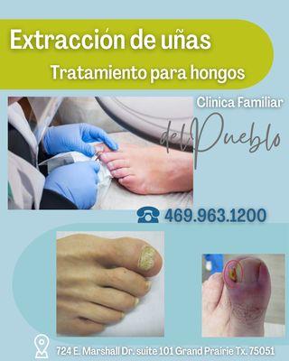 NAIL REMOVAL 
 HONGOS EN LAS UÑAS? 
 PODEMOS AYUDARLO  NO NECESITA CITA 
 PH: 469.963.1200