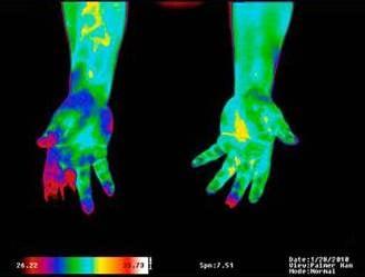 Thermography is completely non-invasive, and does not require the use of radiation.

www.iact-org.org