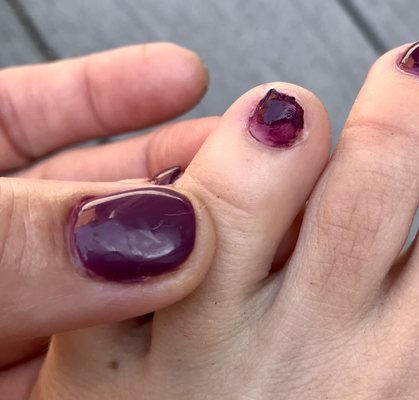 The worst pedicure ever