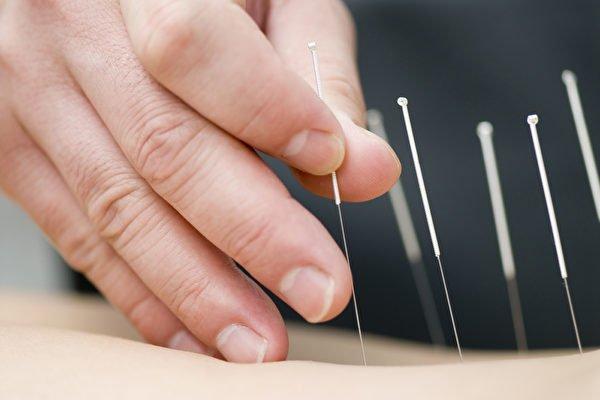 Dr. Hughes, M.D. practices acupuncture. Help you sleep better, reduce stress and eliminate pain!