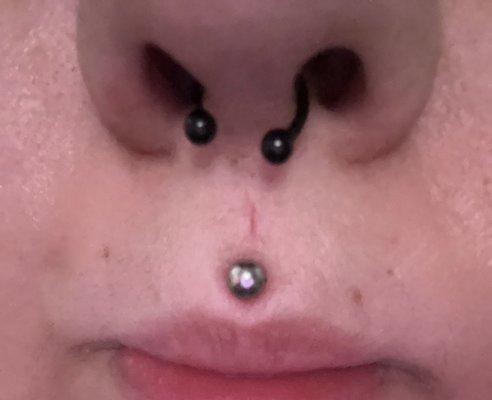 The slit above my Medusa is where the needle went through first...