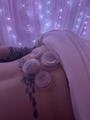 Highly recommend cupping therapy!