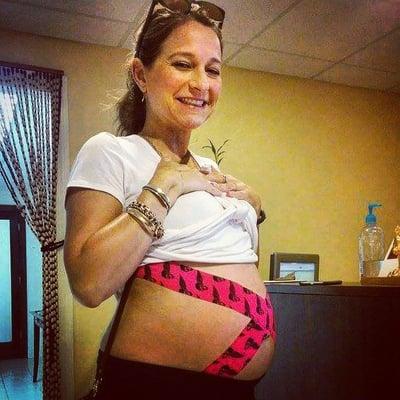 Patient wearing a RockTape baby belt during her pregnancy!