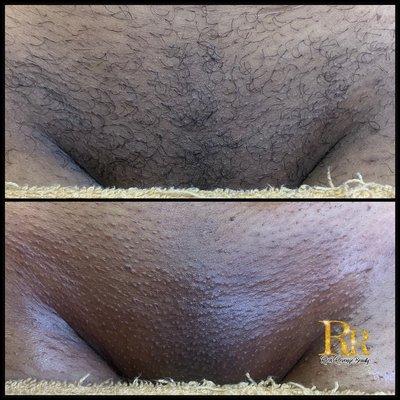 Brazilian Wax