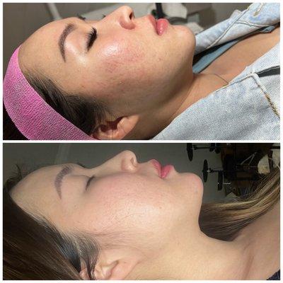 Houston Skin Treatment 