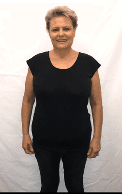 Patient after Medi Weightloss