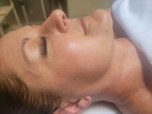 Custom facial