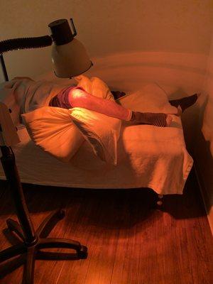 Treating local knee problem with acupuncture needles and infrared heat lamp.