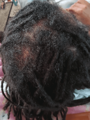 Loc Retwist & Style