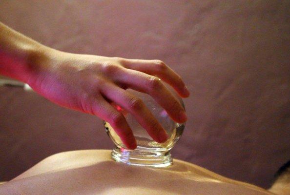 Cupping