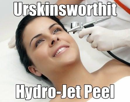 Hydro-Jet Peel - Favorite customized to exfoliate, correct, clean & nourish. It's all in the delivery...Jet Peel!