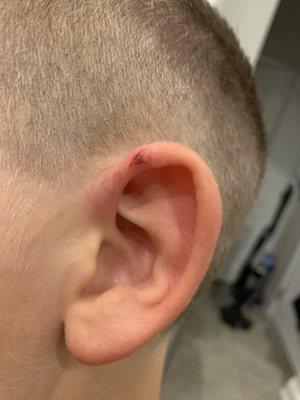 They cut my sons ear