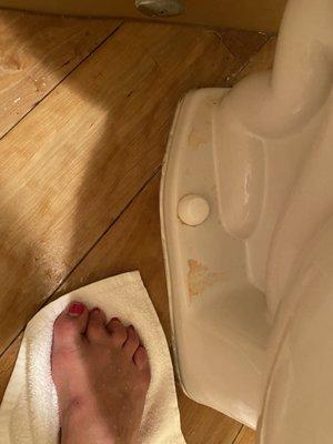 My foot next to the disgusting, dirty, Urine soaked toilet base!