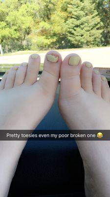 My toes...she was very gentle on my broken toe!!