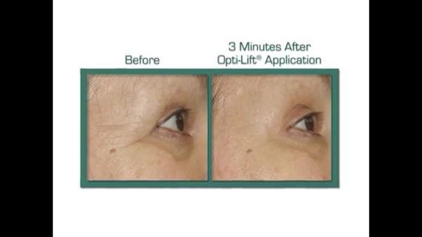 Before and after pictures of 5 Phase Vita Cura Firming Facial