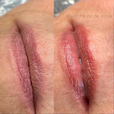 Healed Lip blush.