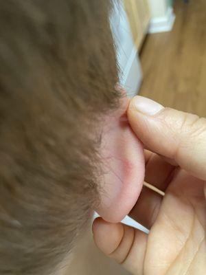 His little scar from his haircut. Still no response to remediate your child being scarred from a simple hair cut.