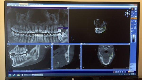 3D CT Imaging