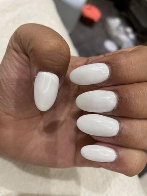 Bad shaped nails